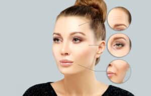 Woman with closeups on eyes, cheeks and forehead where dermal fillers can be used.