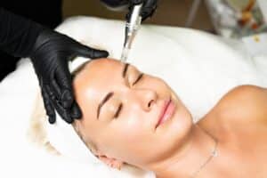 Woman receiving microneedling treatment to face