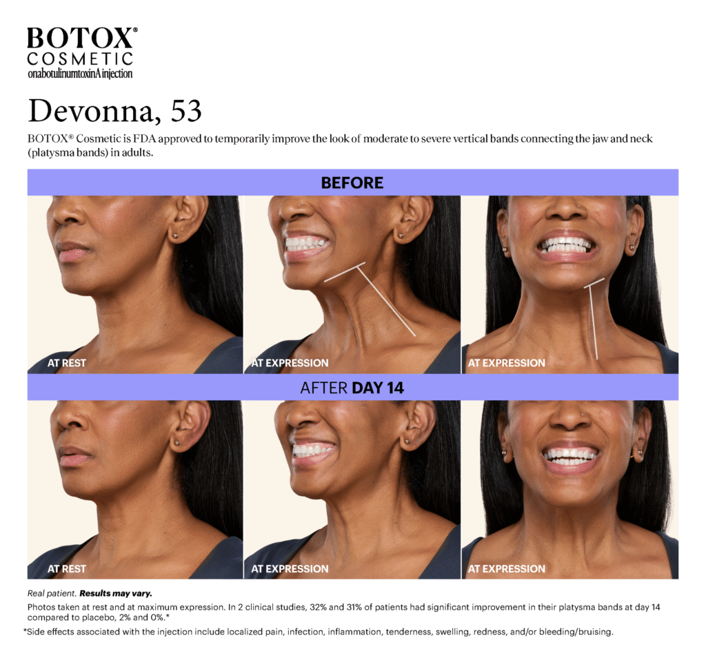 1763568725_Platysma-Downloadable-BnAs_Devonna_Page_3