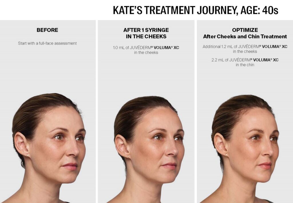 1763569220_JUV161856JUV-Journey-BA-Kate-1_Page_3-1024x712