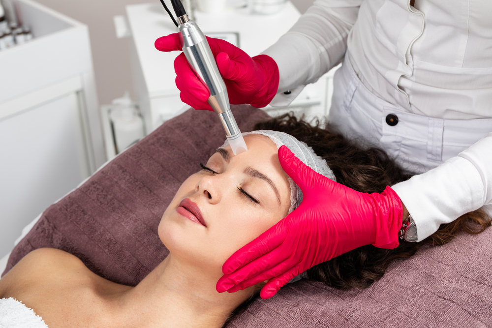 A Beautiful woman receiving microneedling rejuvenation treatment. A Beautiful woman receiving microneedling rejuvenation treatment.